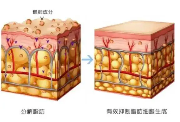 甜菜堿可以促進(jìn)脂肪酸氧化，加快脂肪的分解速率，起到減少脂肪堆積的作用